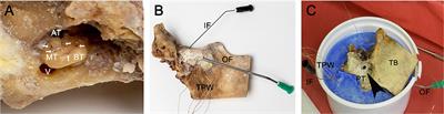 Measurement of the Intracochlear Hypothermia Distribution Utilizing Tympanic Cavity Hypothermic Rinsing Technique in a Cochlea Hypothermia Model